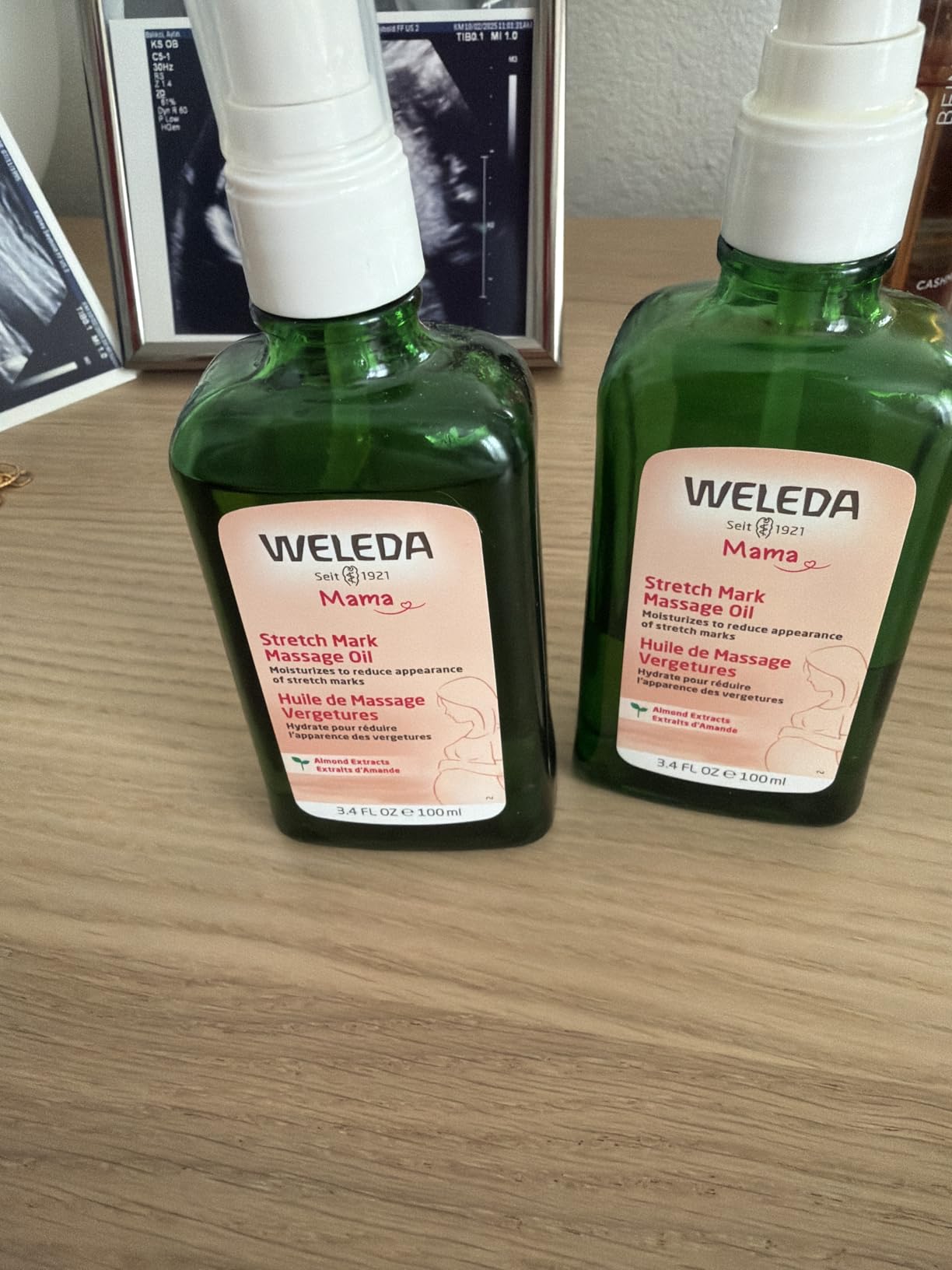 Weleda Stretch Mark Pregnancy Massage Oil, 3.4 Fluid Ounce, Plant Rich Oil with Vitamin E, Sweet Almond, Jojoba and Arnica Oils customer photo 1