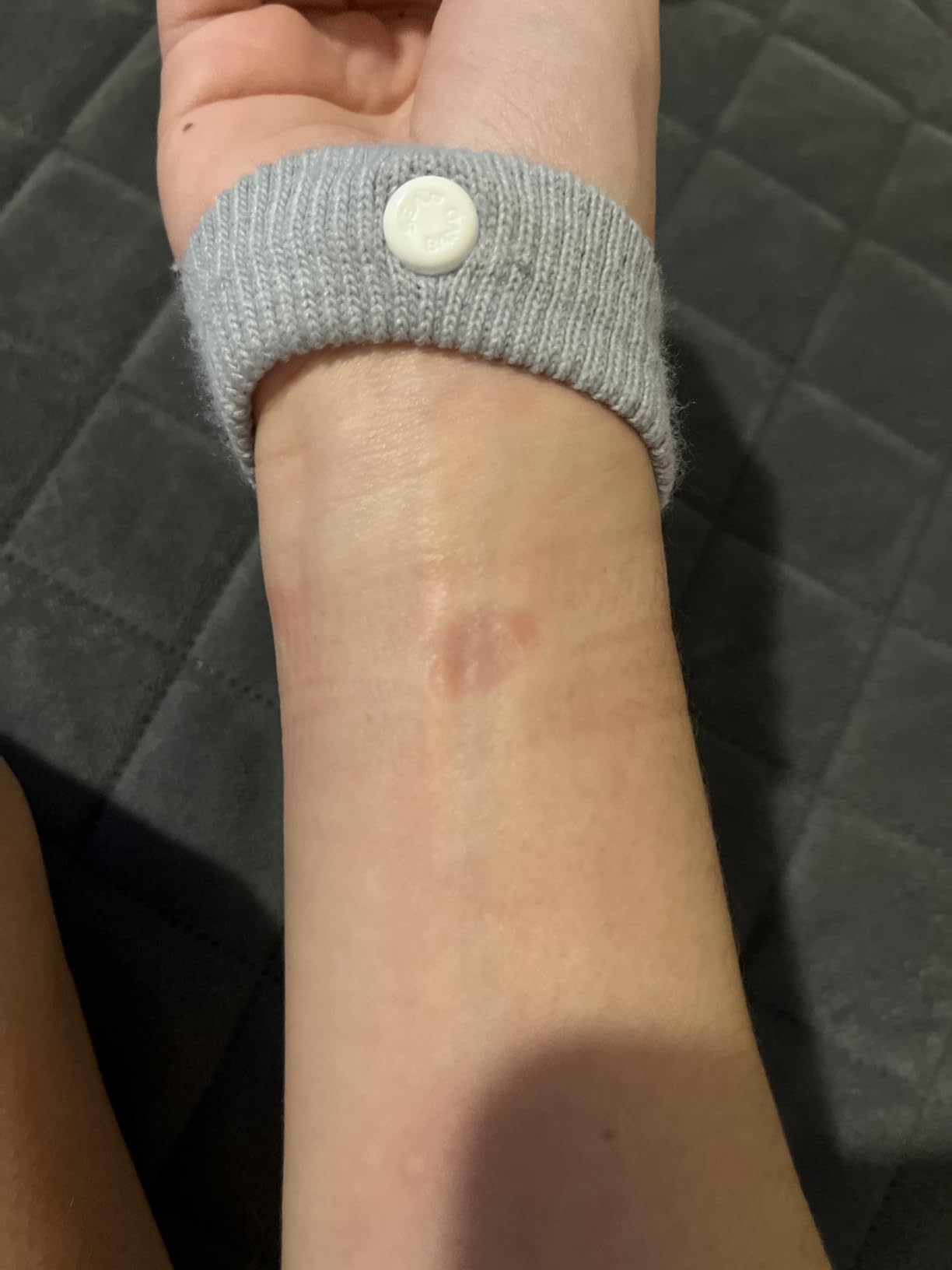 Sea-Band Anti-Nausea Acupressure Wristband for Motion & Morning Sickness, 1 Pair, Gray customer photo 2