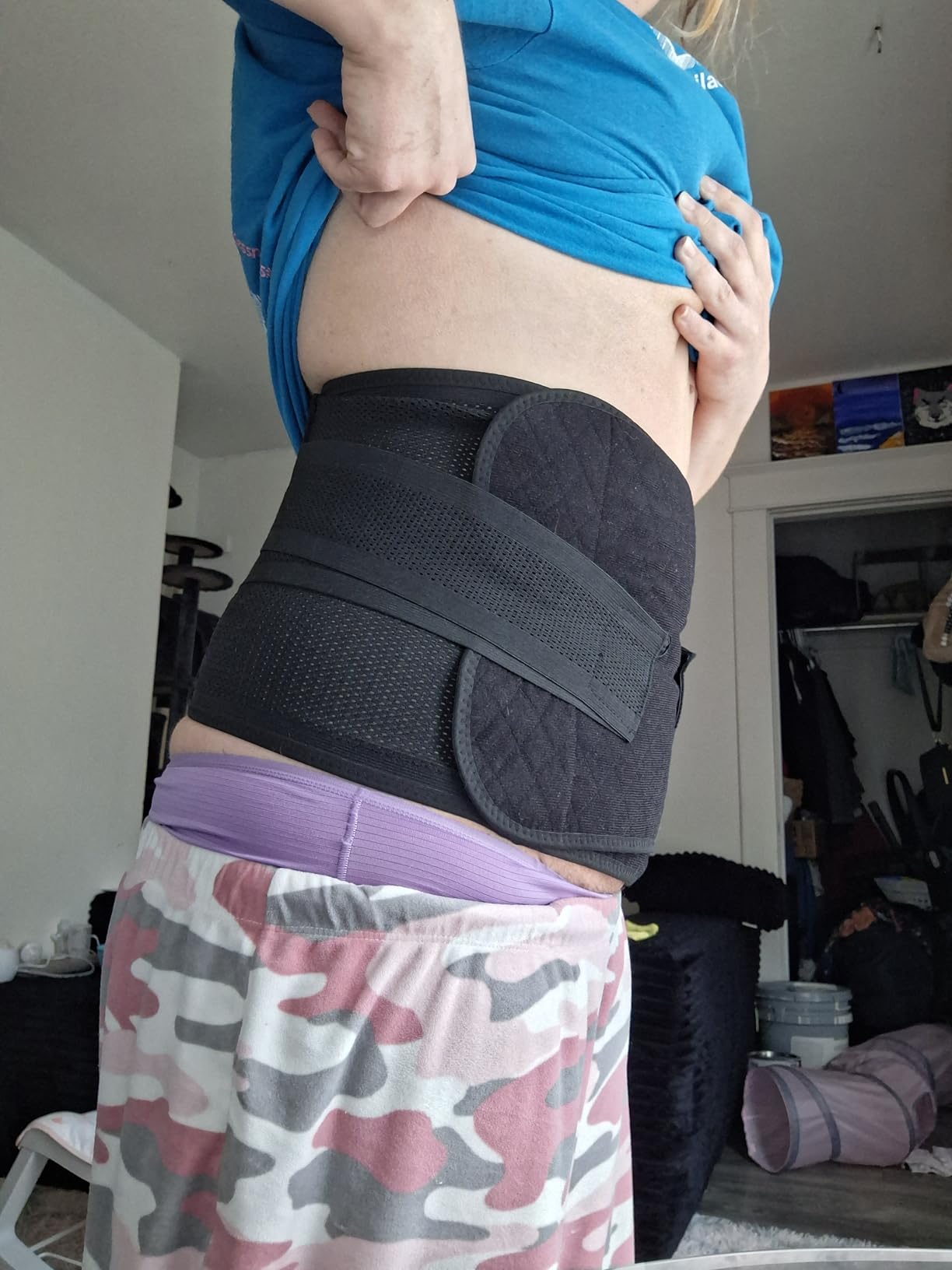 Trendyline Postpartum Belly Band, C Section Belly Binder, Abdominal Binder Post Surgery Girdle, Tummy Tuck Compression Wrap customer photo 1