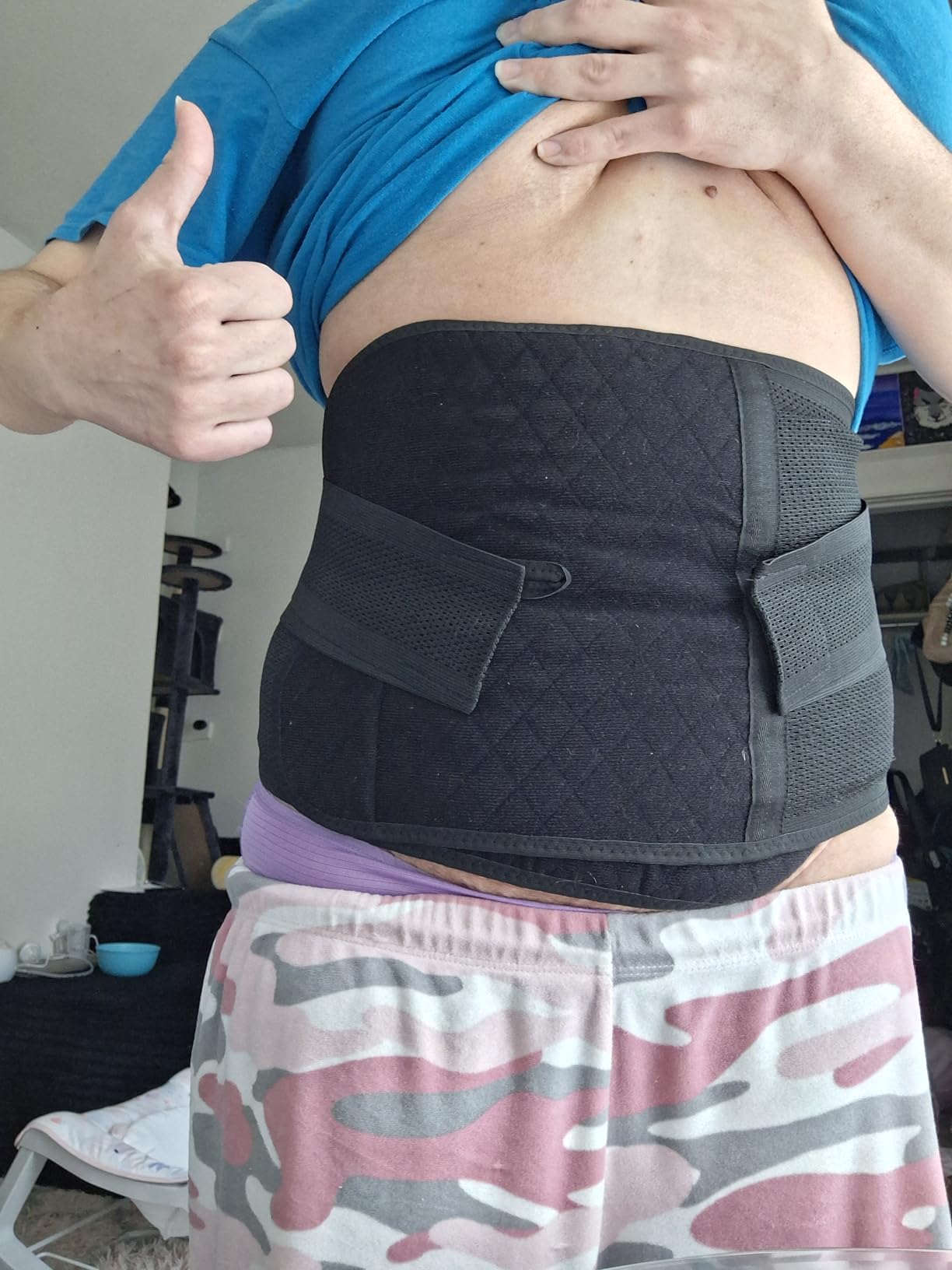 Trendyline Postpartum Belly Band, C Section Belly Binder, Abdominal Binder Post Surgery Girdle, Tummy Tuck Compression Wrap customer photo 2