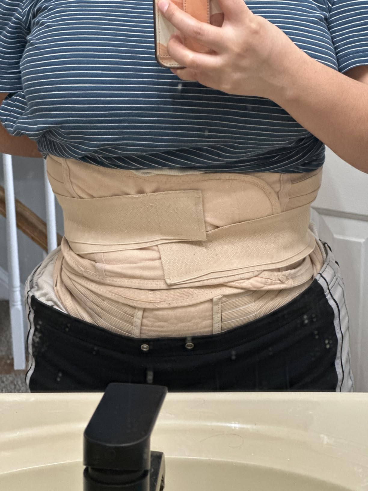 ChongErfei 3 in 1 Postpartum Belly Wrap - Recovery Belly/Waist/Pelvis Belt customer photo 1