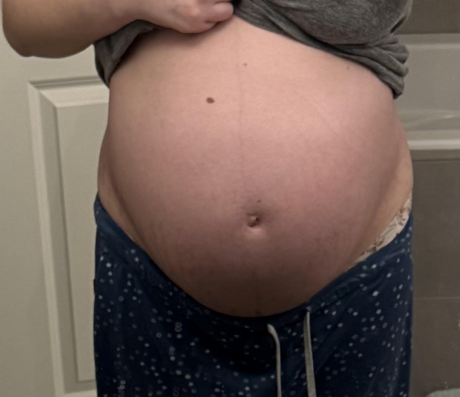HATCH Belly Oil, Pregnancy & Postpartum Skincare for Stretch Marks, Quick-Drying for Full Body & Soothes Irritation, Plus Vegan, Clean & Plant-Based, 6.7 Fl Oz customer photo 2