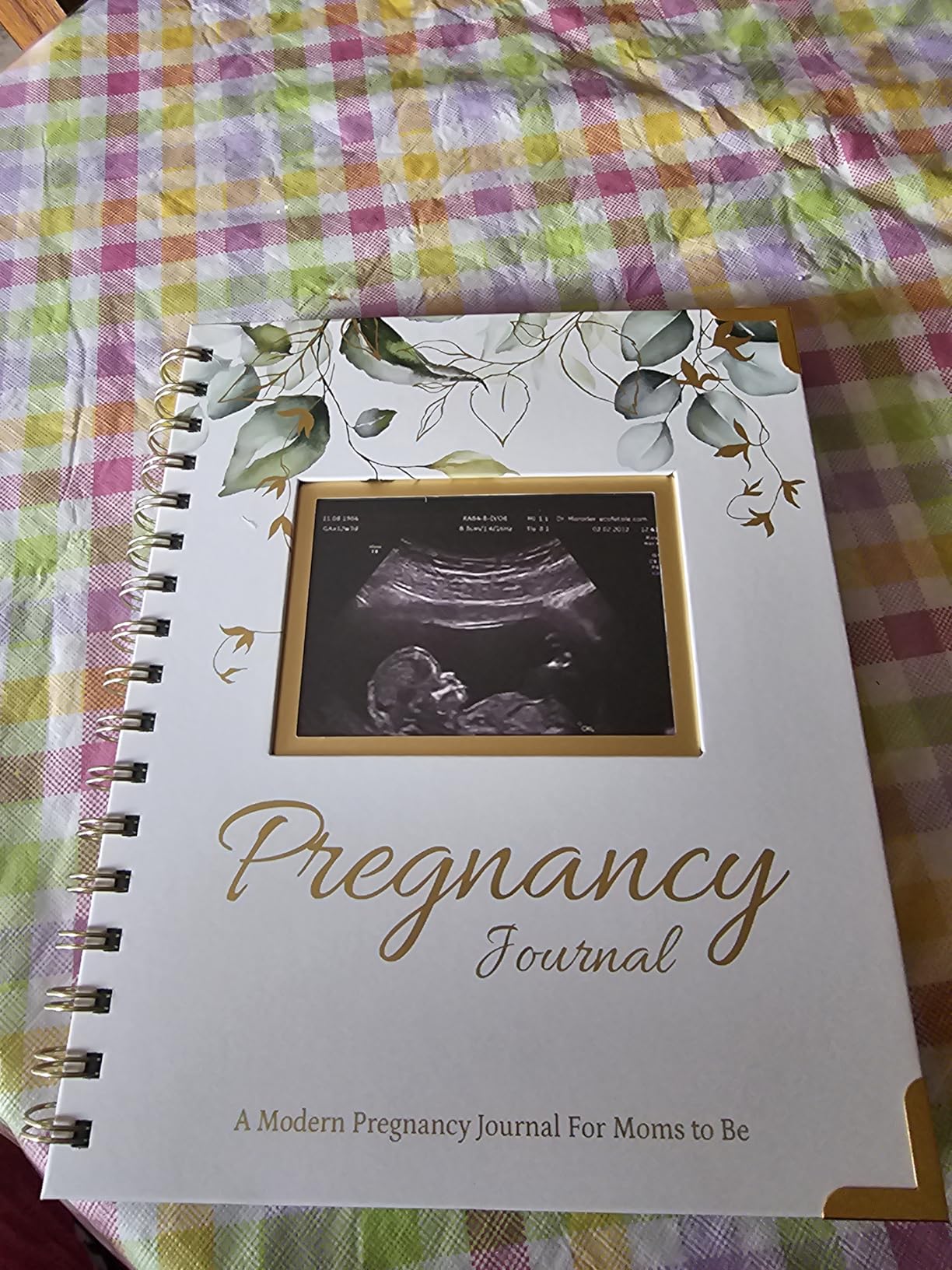 Pregnancy Journal for First Time Moms Gifts - 90 Pages Hardcover Pregnancy Memory Book, Beautiful & Cute Baby Book Keepsake, Ultrasound Baby Scrapbook, Mom To Be Gift (Alpine) customer photo 1