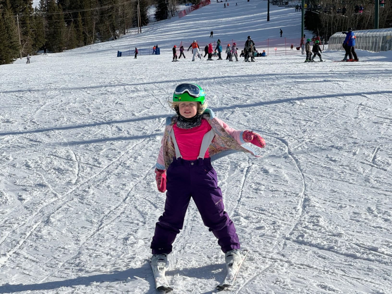 Supertrip Kids Ski Goggles, Anti-Fog Snow Snowboard Goggles for Kids Boys Girls Youth Age 5-15 customer photo 2