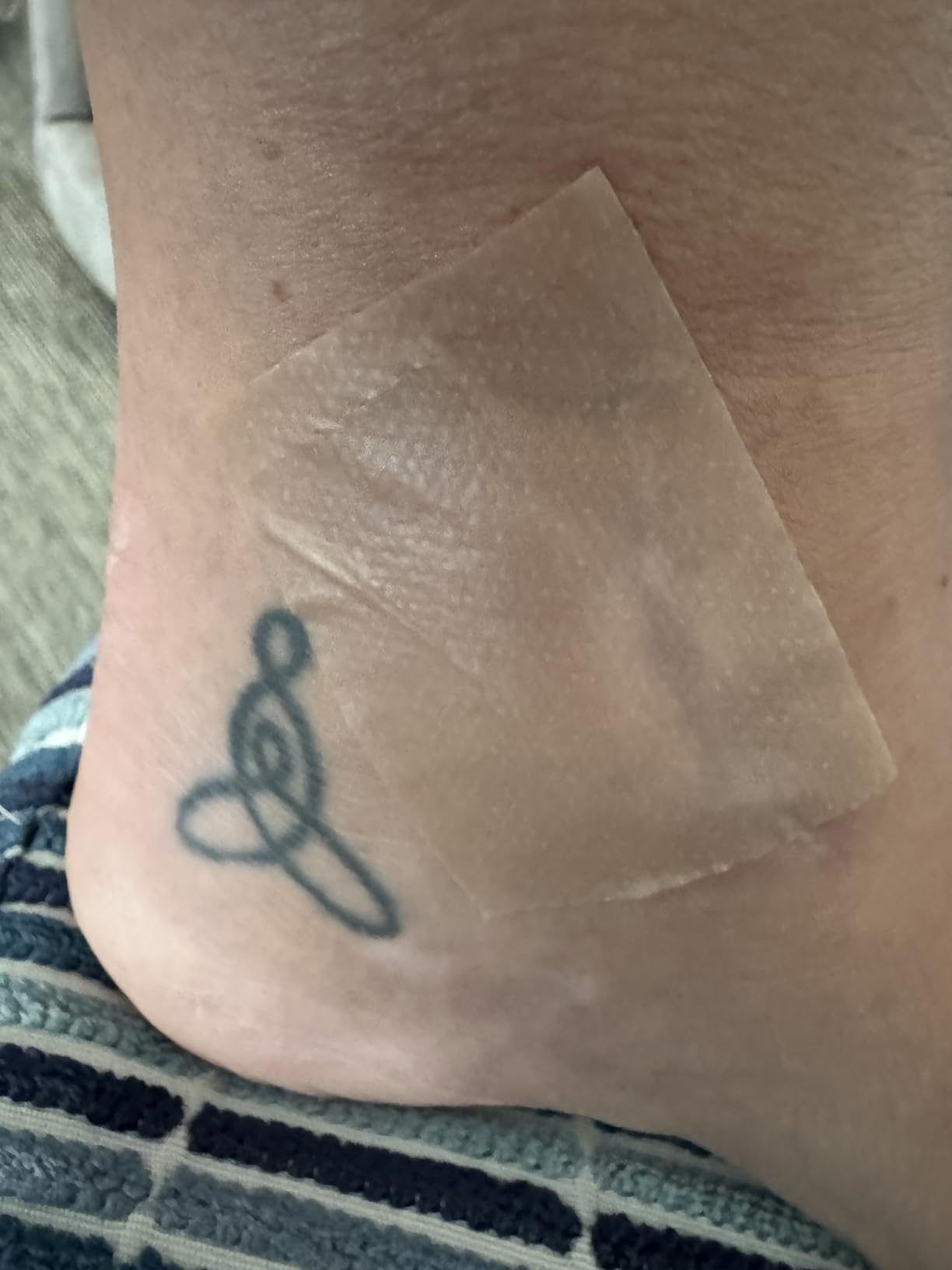 Pumkot Silicone Scar Sheets, Silicone Scar Tape(1.6