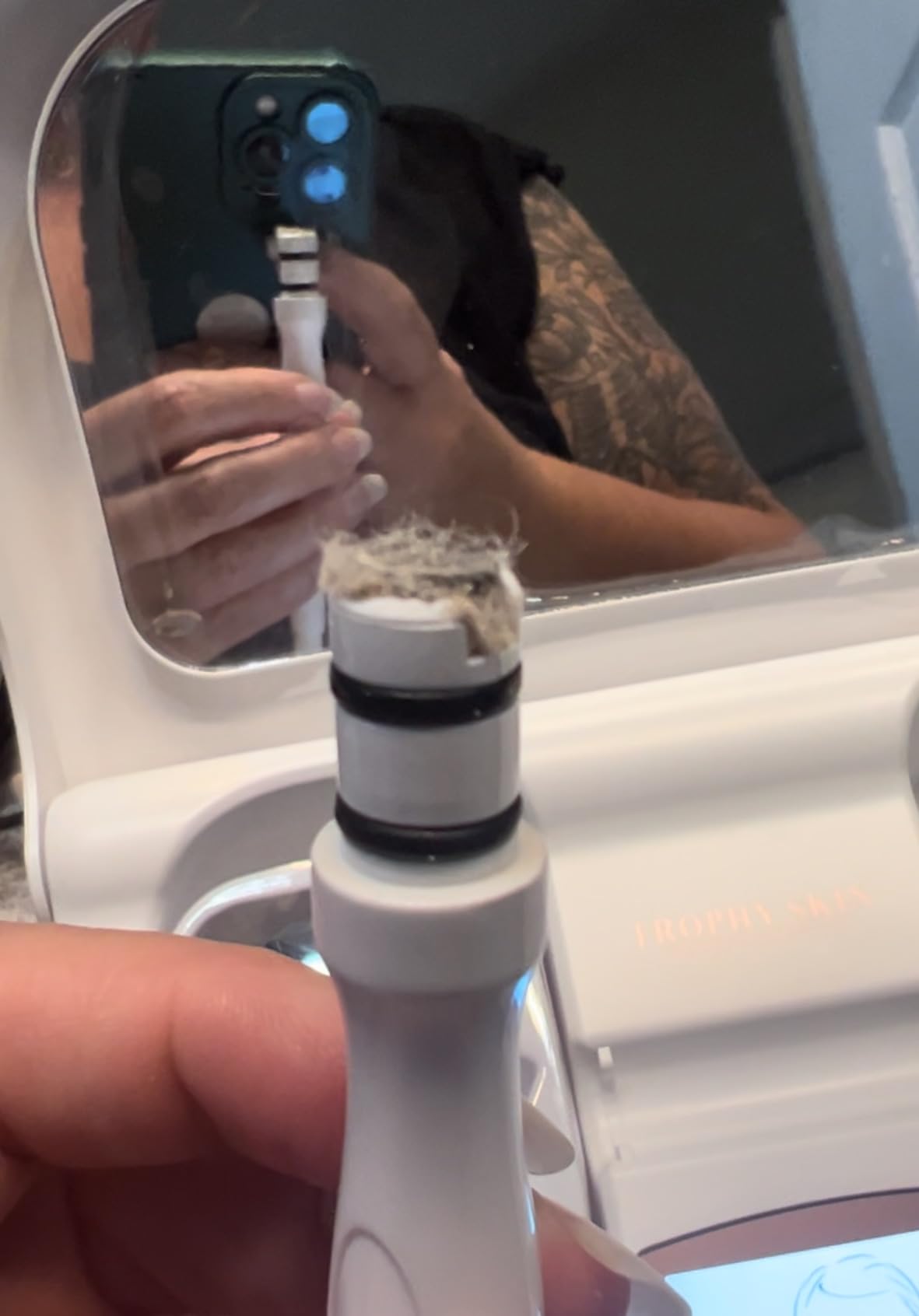 Trophy Skin MicrodermMD - At Home Microdermabrasion Kit - Anti Aging and Acne Treatment customer photo 2