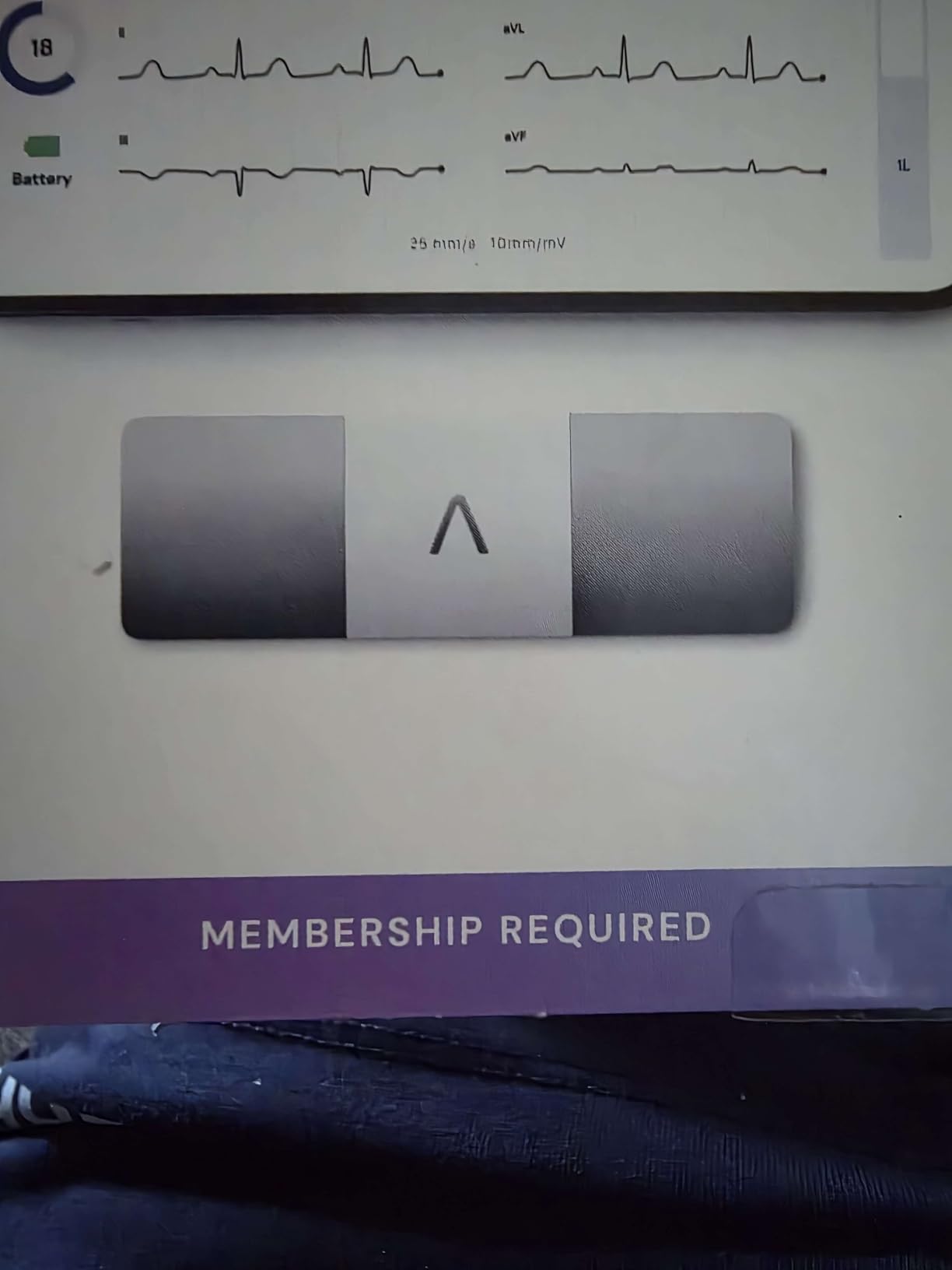 KardiaMobile 6L Max 6-Lead EKG + One-Year Membership, Unlimited Recordings | Detects 6 Arrhythmias, FDA-Cleared Heart Monitor, Medical-Grade Results in 30 Seconds, Works with Smartphones and Tablets customer photo 1