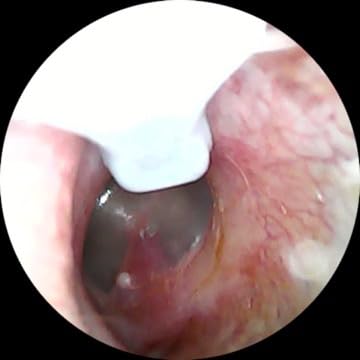LEIPUT Ear Wax Removal - Ear Cleaner with 1080P Camera, IP67 Waterproof Lens, 6 Soft Silicone Ear Scoops, WiFi for iOS & Android (Black) customer photo 1