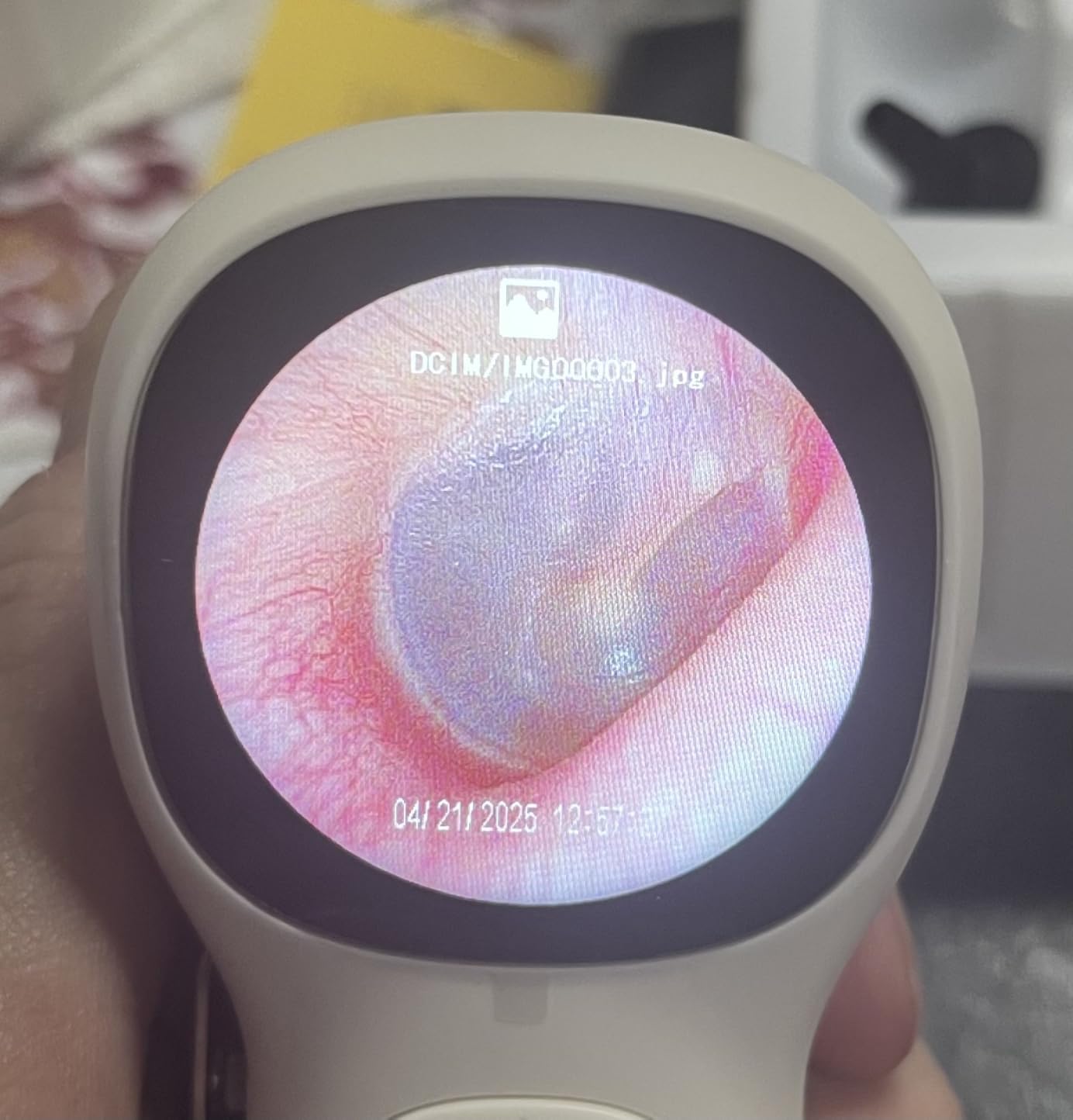Otoscope with Light, No App Needed, HD Screen, Ear Scope Camera for Family customer photo 1
