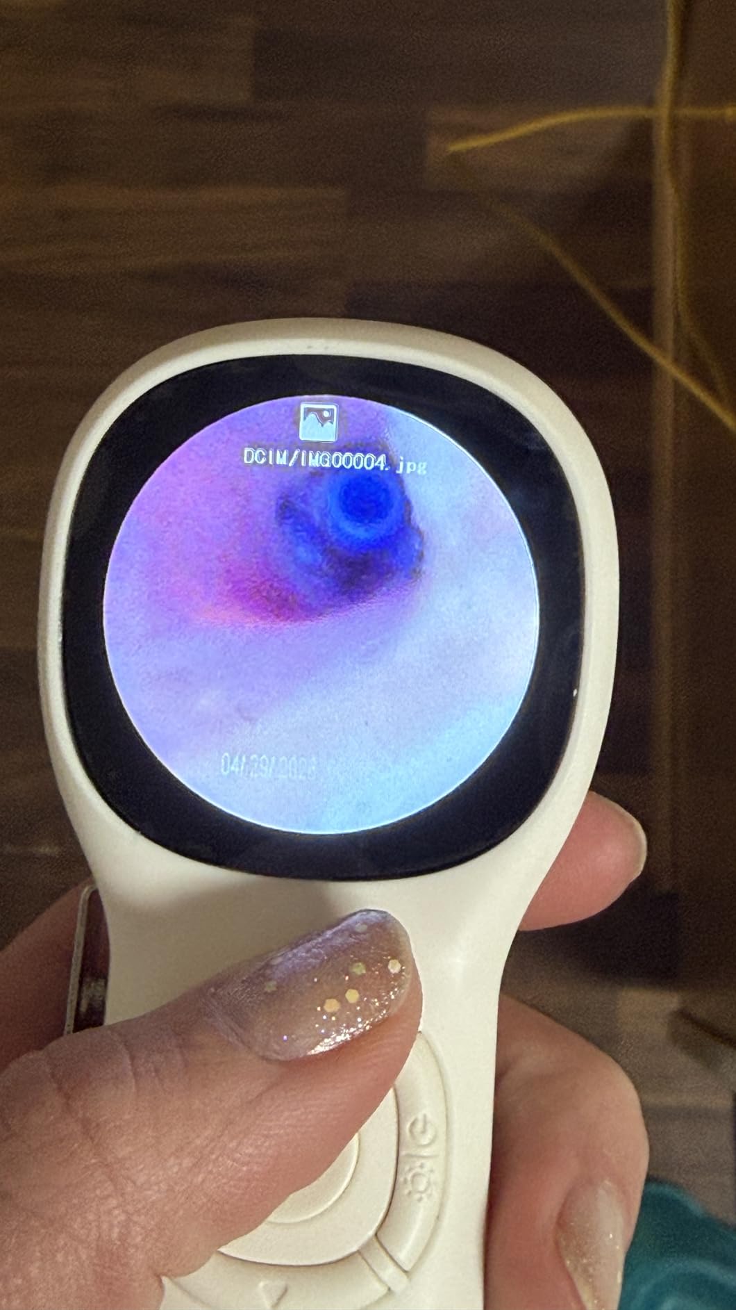 Otoscope with Light, No App Needed, HD Screen, Ear Scope Camera for Family customer photo 2