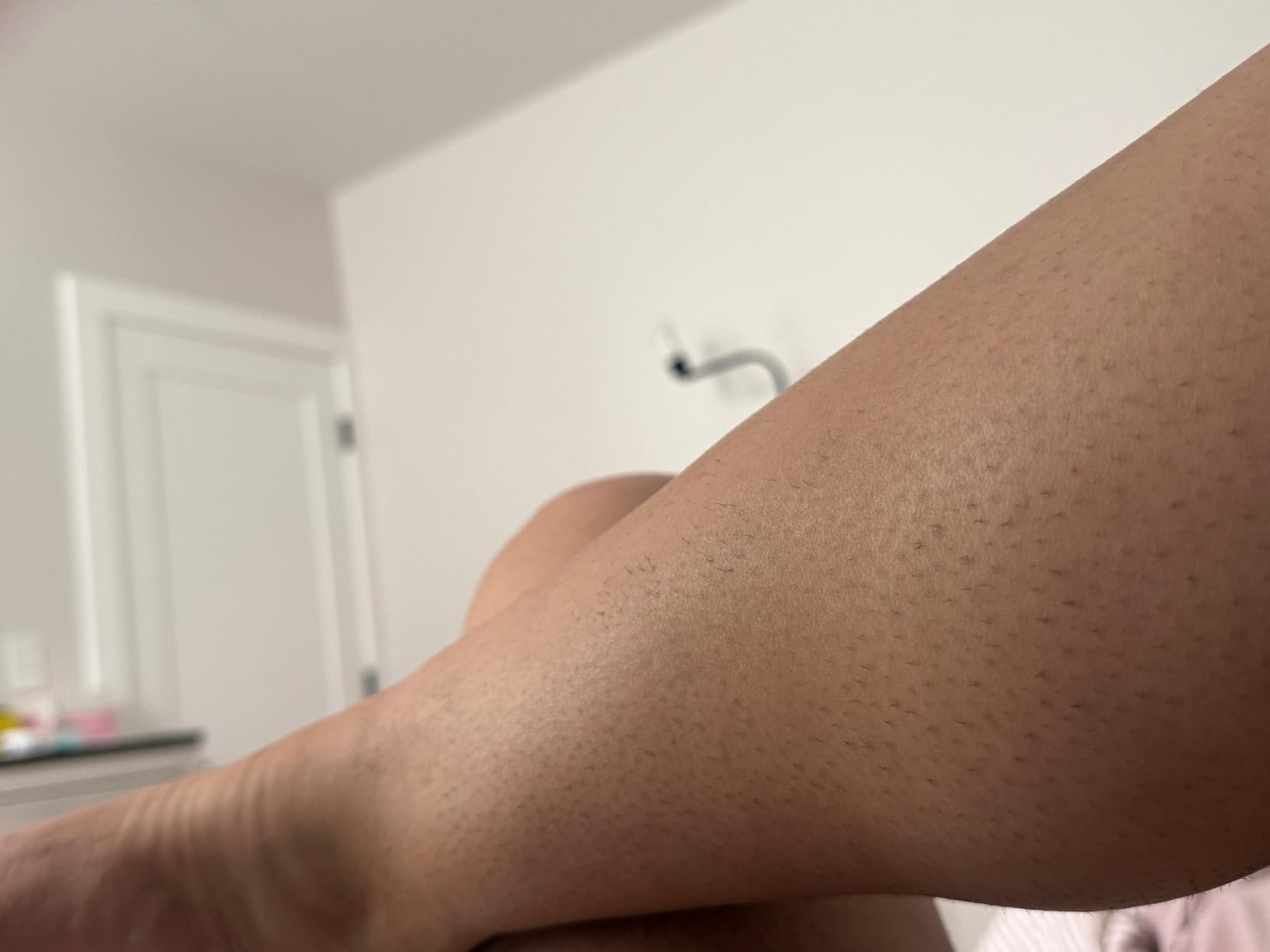 Philips Lumea IPL Salon-Like Laser Hair Removal for Women, Permanent Hair Reduction Device At Home for Face & Body, Safe & Painless for Face, Bikini, Body, 5 Settings & Skin Sensors, BRI984/03 customer photo 2