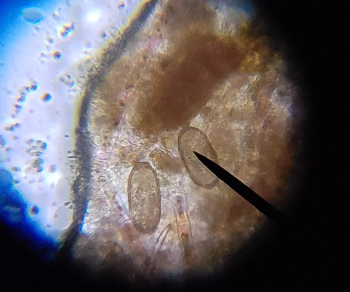 AmScope M150C 1000X All-Metal Optical Glass Lenses Cordless LED | 40X-1000X Magnification Range Compound Biological Microscope All-Metal Construction Cordless Battery Powered customer photo 2