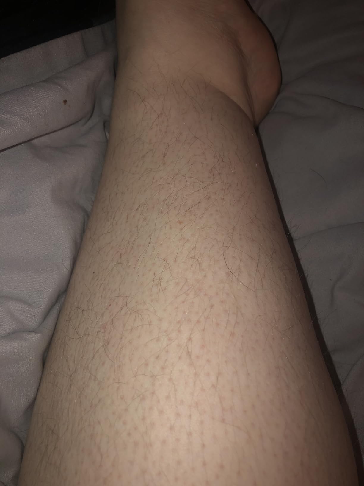 Philips SatinShave Essential Women’s Wet & Dry Electric Shaver for Legs & Body, Cordless, with Hypoallergenic Foil, HP6306/50 customer photo 2