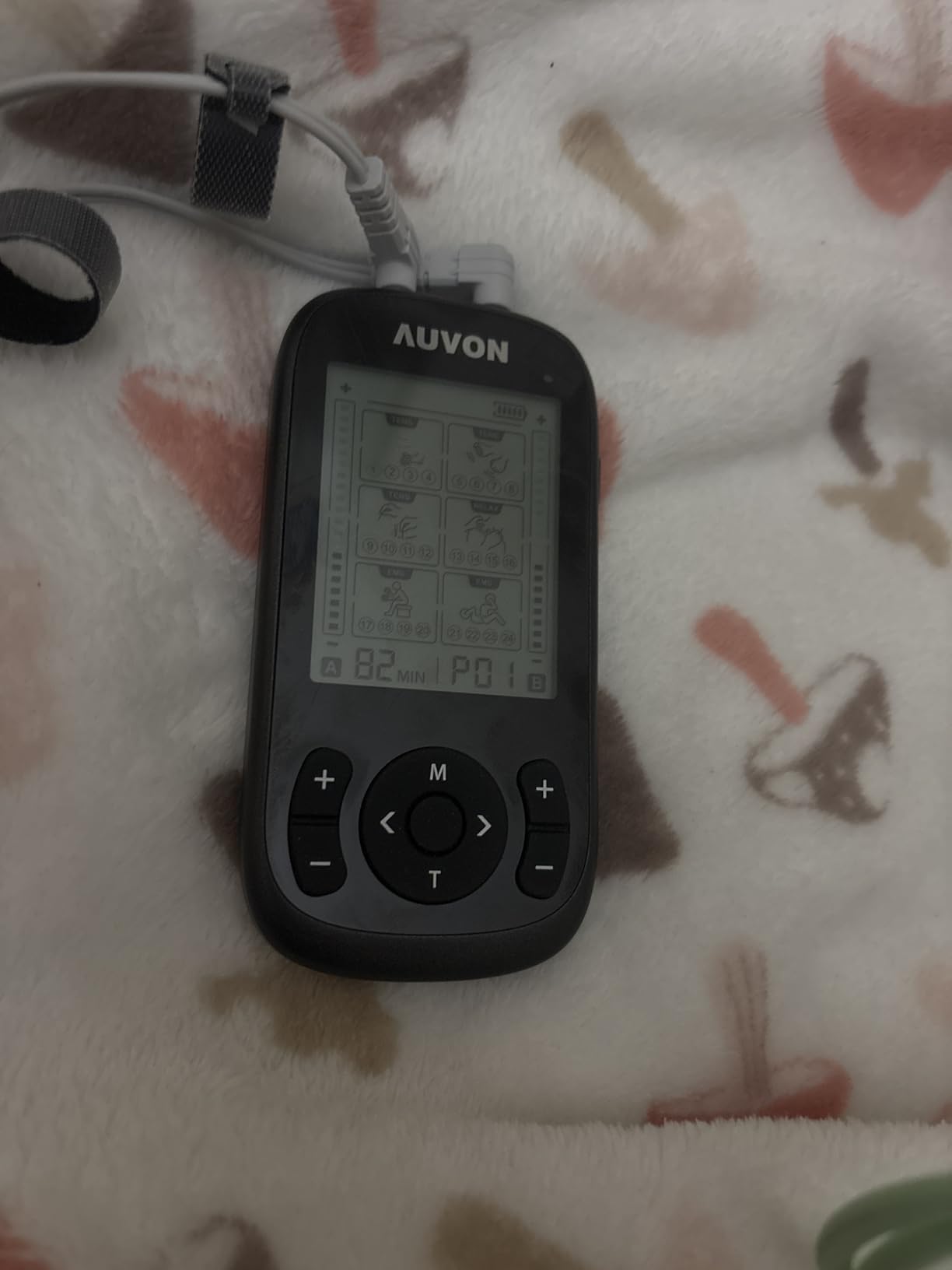AUVON 3-in-1 TENS Unit Muscle Stimulator, 40 Levels for Gradual Pain Relief customer photo 1