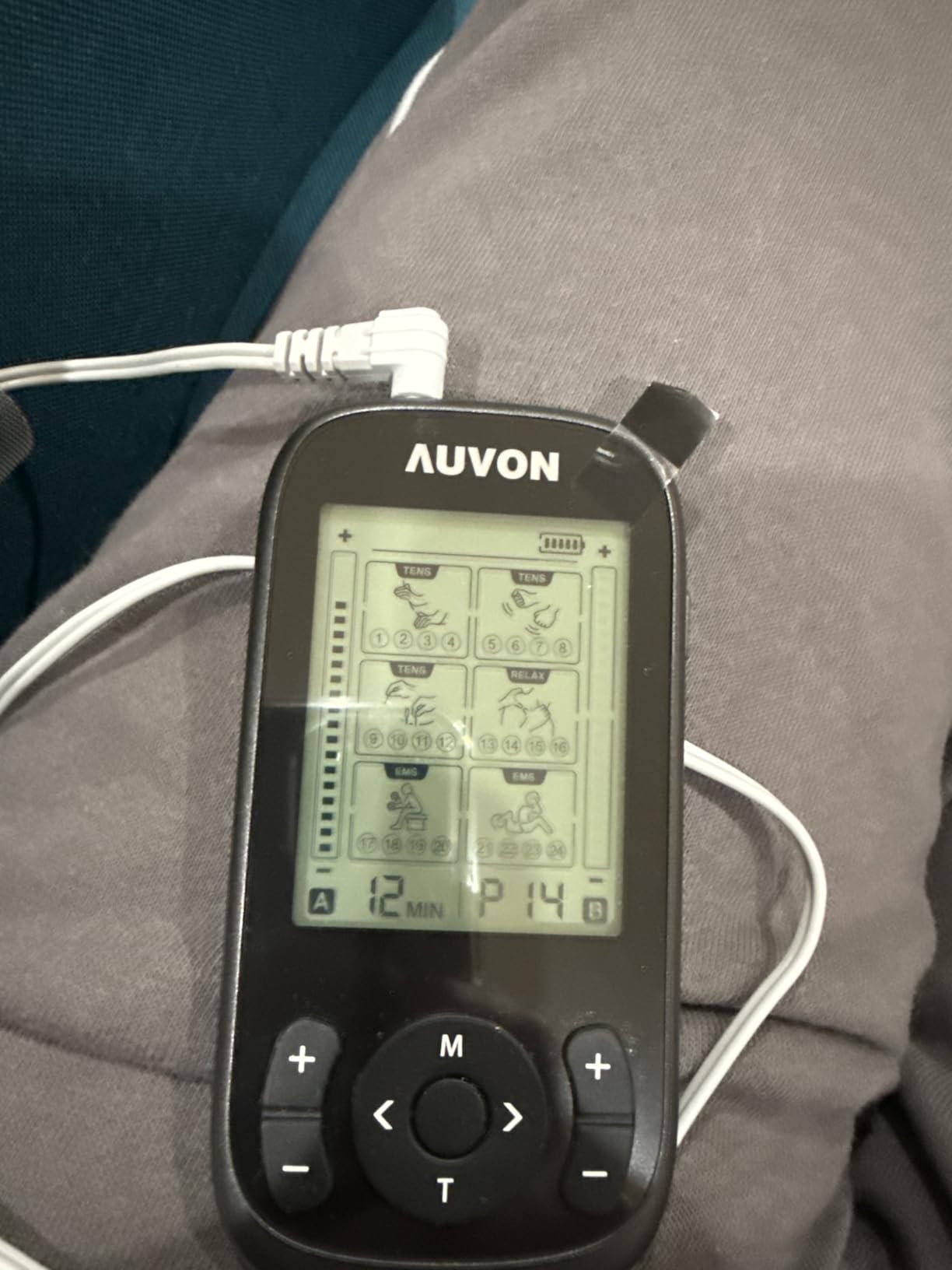 AUVON 3-in-1 TENS Unit Muscle Stimulator, 40 Levels for Gradual Pain Relief customer photo 2