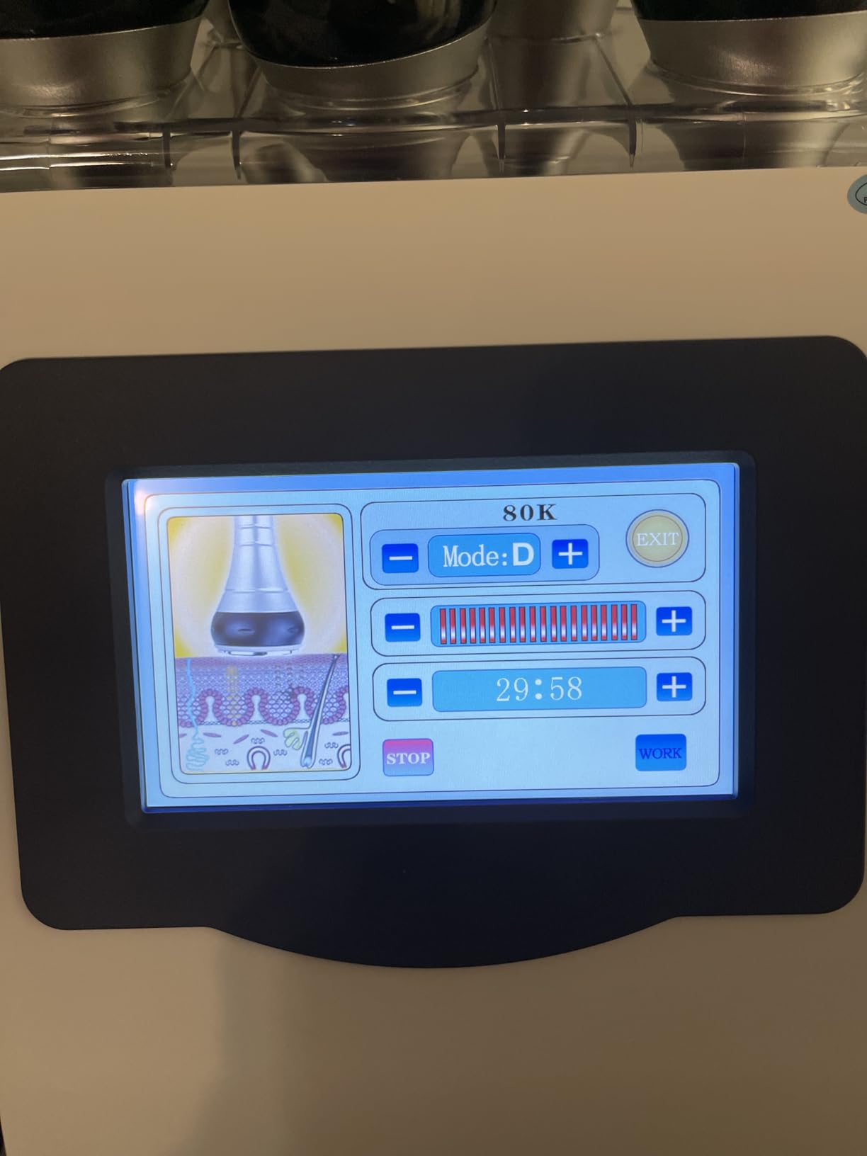 Body Massager Multifunction Beauty for Improvement in The Appearance of Cellulite Device customer photo 1
