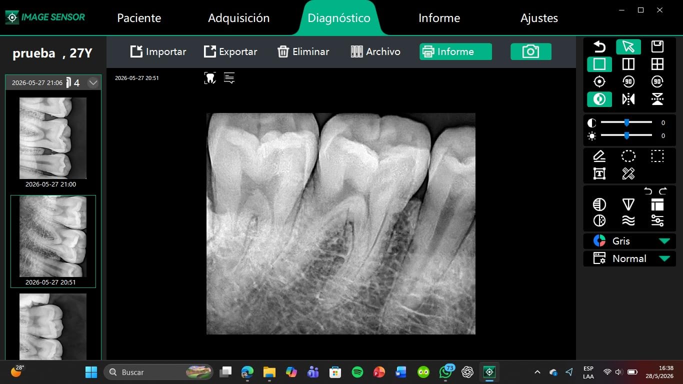 Handheld Dental Xray Machine Portable, Digital Intraoral X-Ray Sensor System for Dental Veterinary Clinic customer photo 1