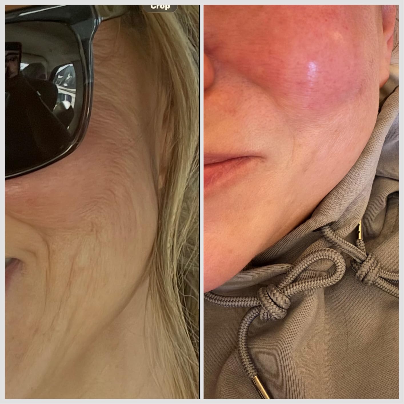 RoC Retinol Correxion Deep Wrinkle Retinol Face Serum, Ascorbic Acid, 1 0z customer photo 1