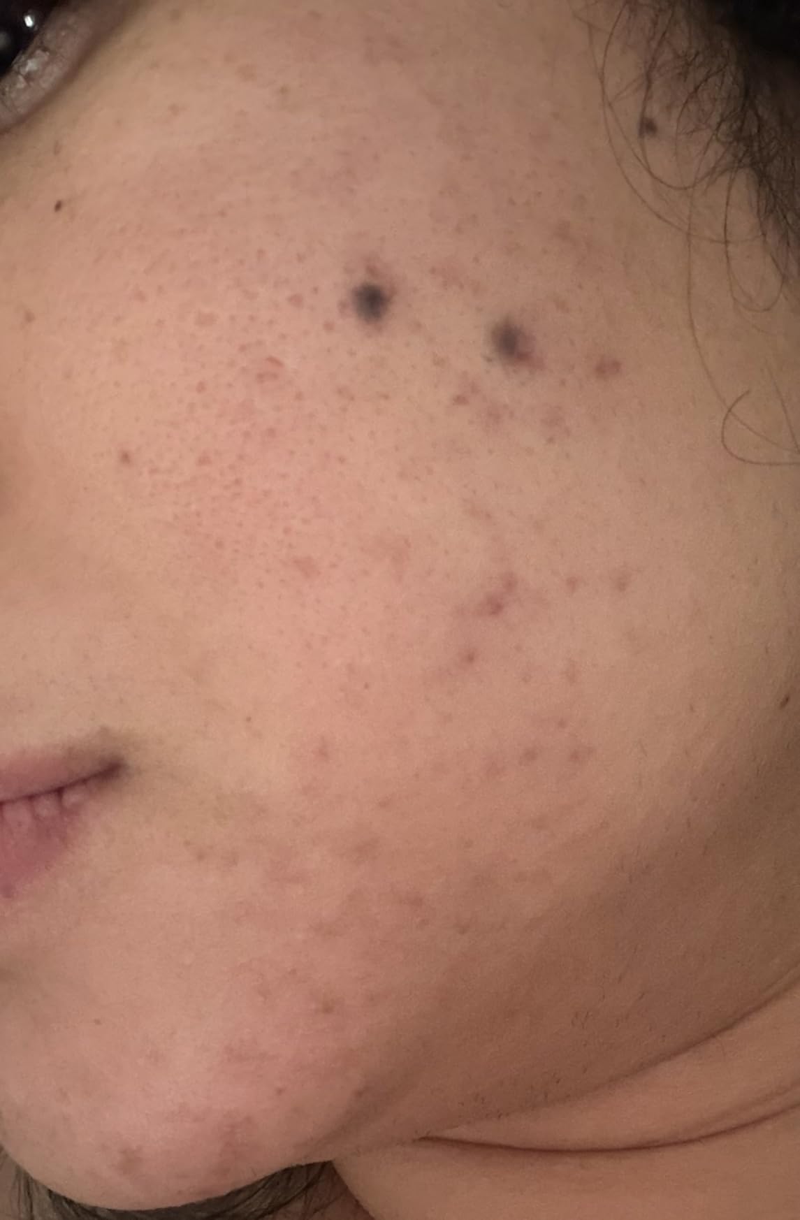 CeraVe Resurfacing Retinol Face Serum with Niacinamide, Pore Minimizer, 1oz customer photo 1